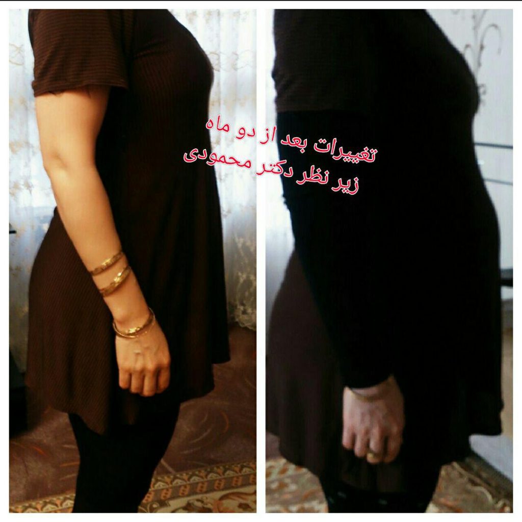 لاغری و چاقی